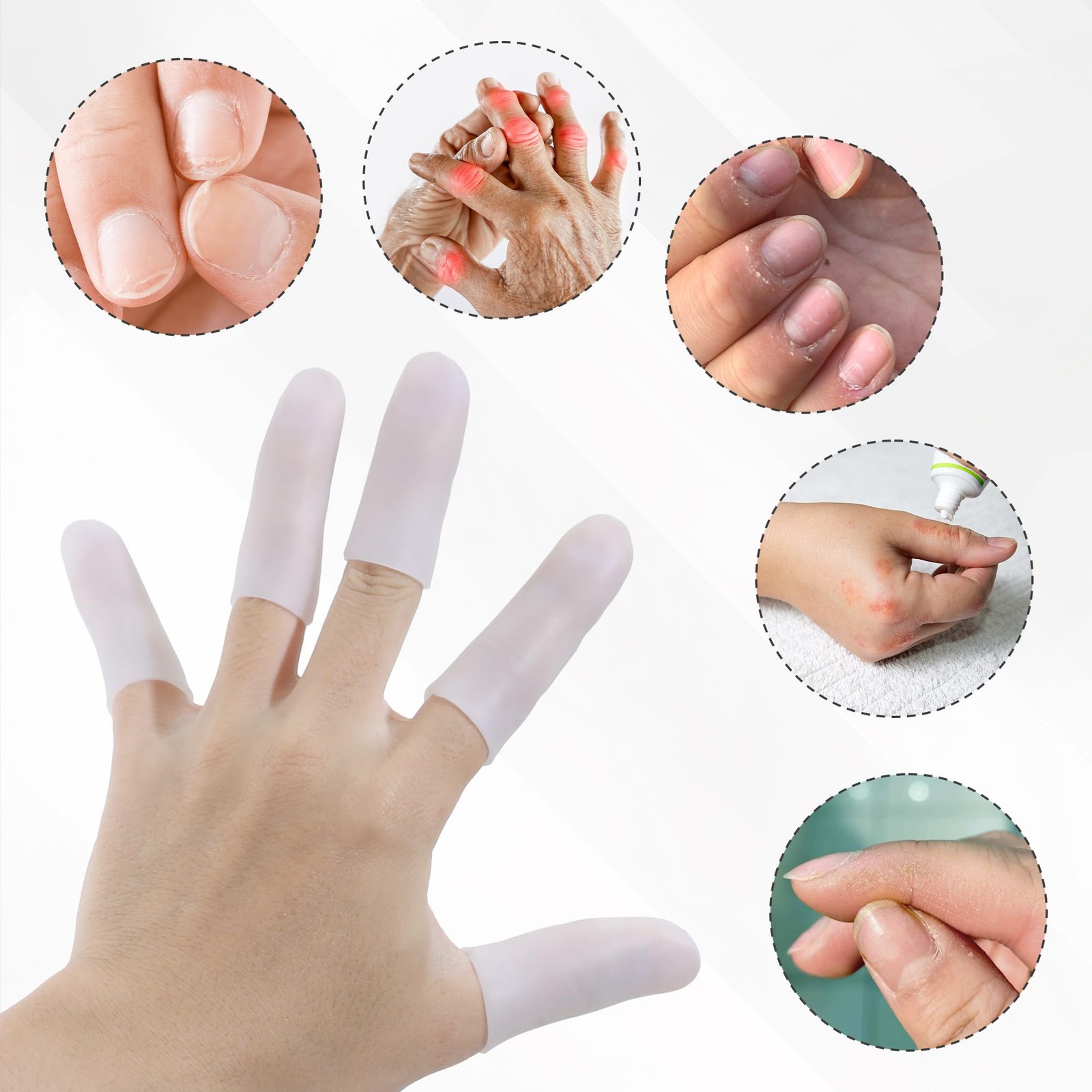 20 PCS Gel Silicone Finger Cots Protectors Sleeves Thumb Support Eczema Care