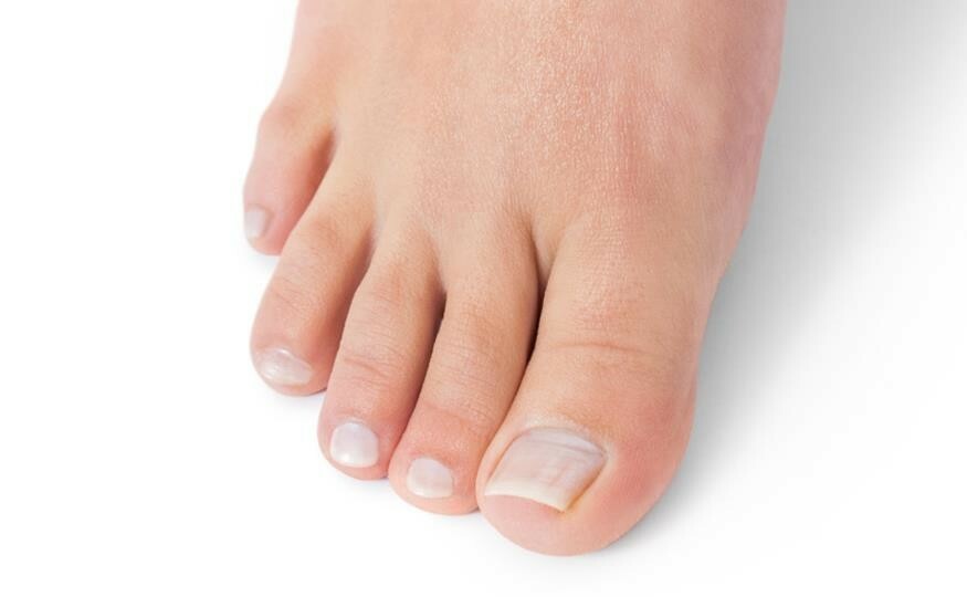 ORIUNDO natural life / Nail Fungus Away (Quita Hongos para Uñas)