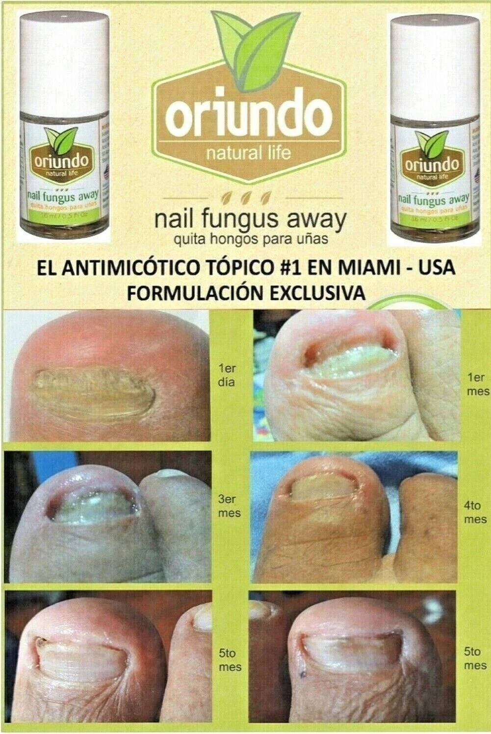 ORIUNDO Natural Life / Nail Fungus Away (Quita Hongos para Uñas) 0.5 Oz (2 Pack)