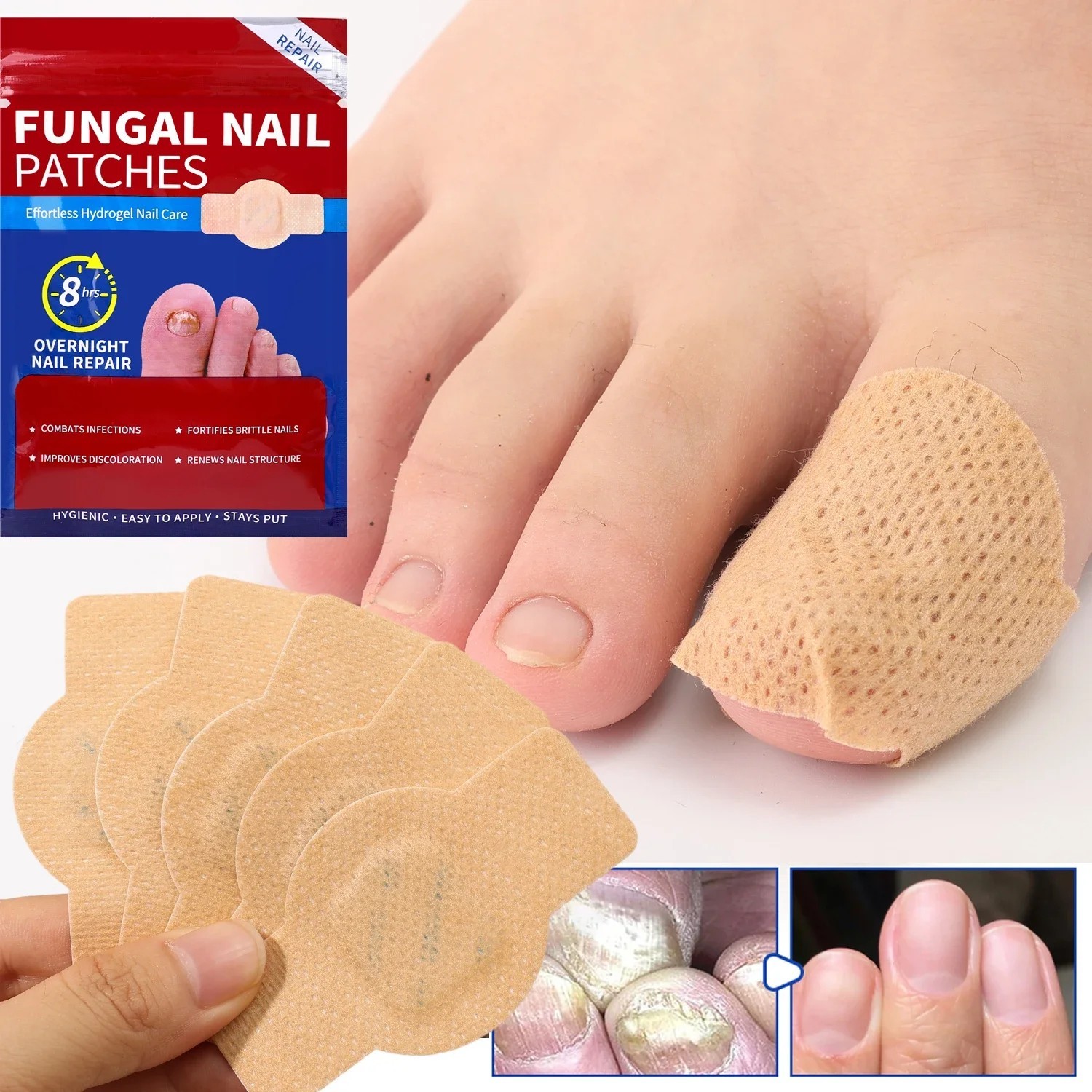 21 Pcs Fungal Nail Patches – Extra Strength Toenail Fungus Treatment Overnight