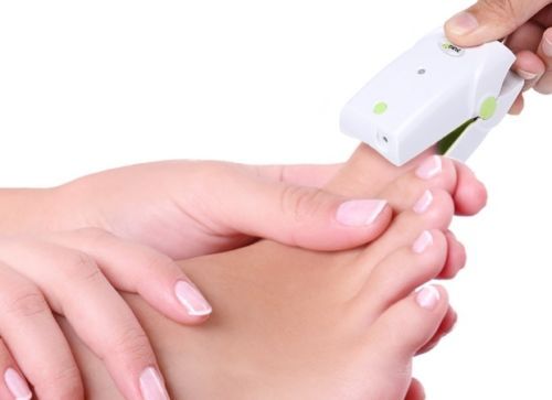 Rechargeable portable nail fungus laser therapy toe nail laser toenail fungus CE