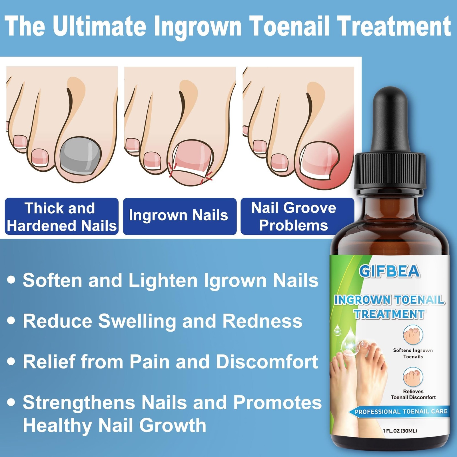 Ingrown Toenail Treatment w/Ingrown Toenail Drops Reliever & Softener,Double …