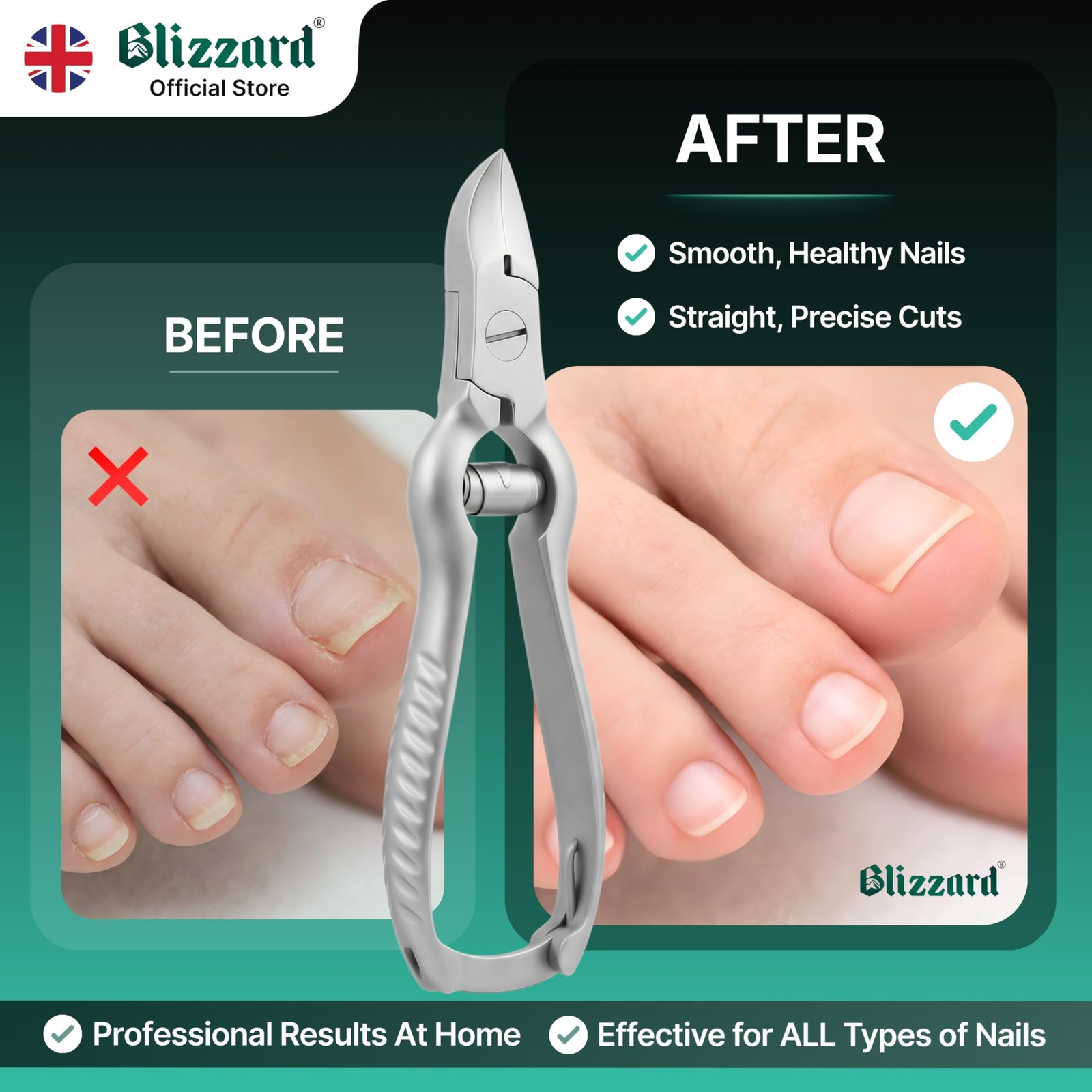 Blizzard Professional Toe Nail Clippers for Men – Podiatry Heavy Duty Toenail…