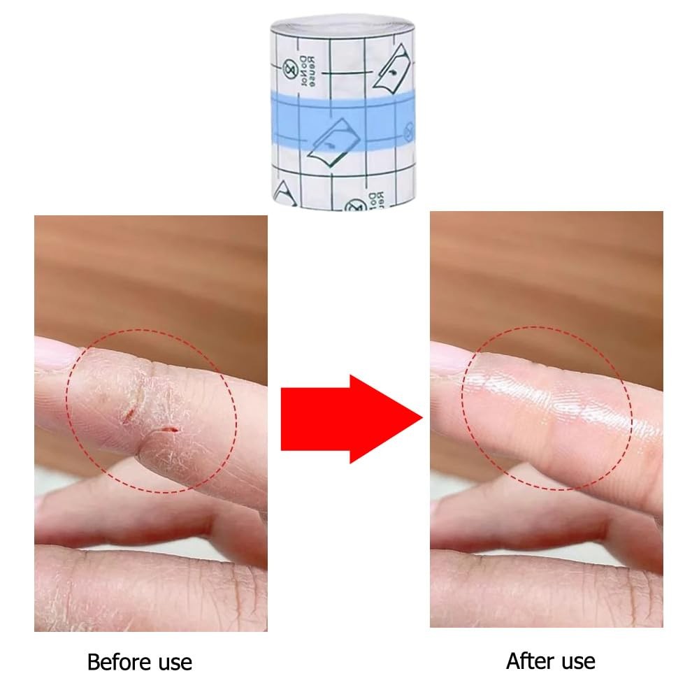 Finger Tape Cracked Hands Patches Fingertip Bandages Knuckle Bandages Transpa…