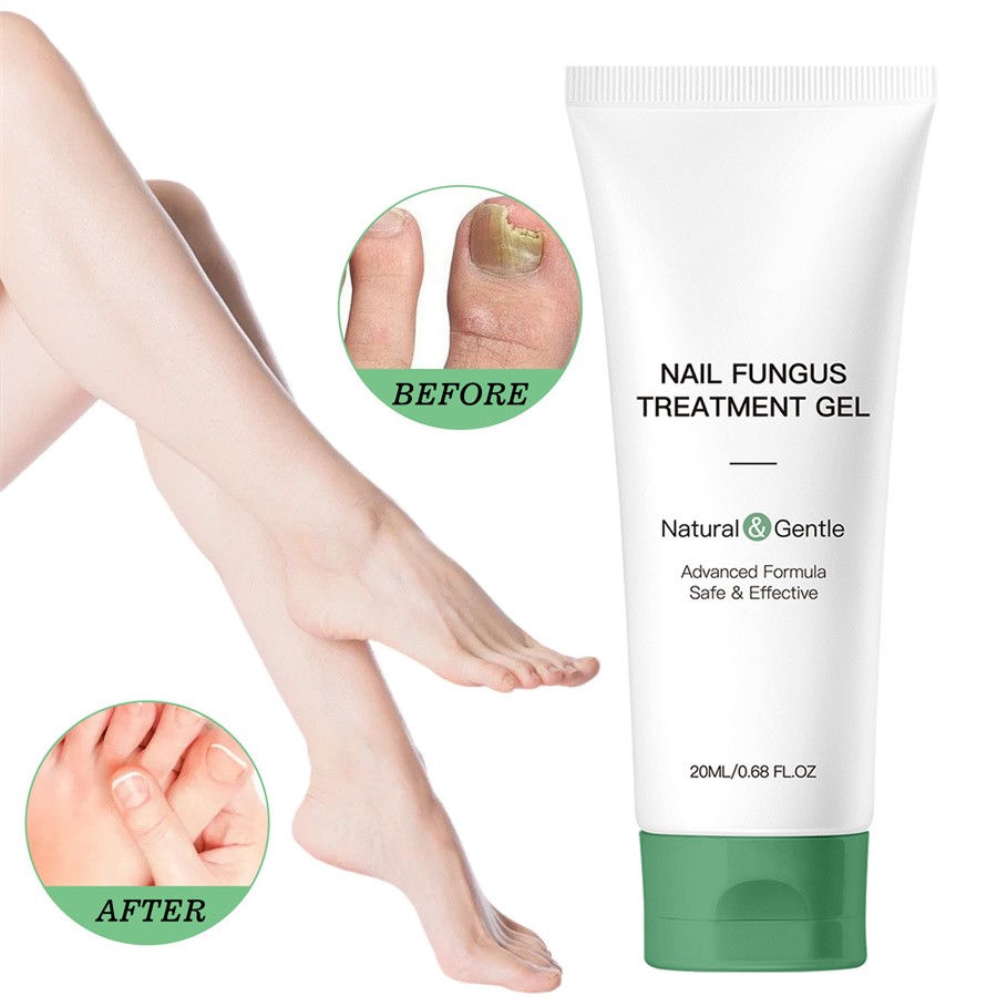 Nutraboost Nail Fungus Treatment Gel, Natural Nail Repair Strengthening Gel