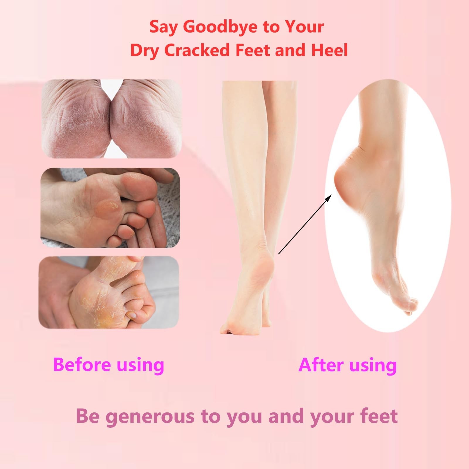 Upgrade 1200RPM Electric Foot Callus Remover, Aluminum Electric Callus Remove…