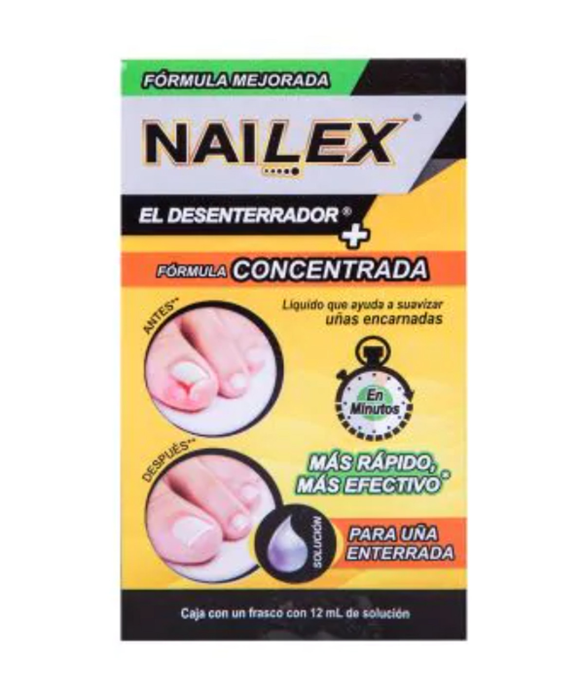NAILEX INGROWN TOE NAIL SOFTENER CONCENTRA 12ml. – NO IMPORT FEES