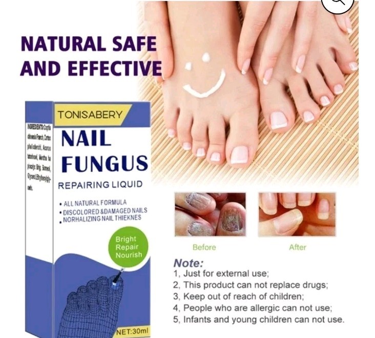 Nail Fungus Treatment For Toe and Finger Nails 30 ml