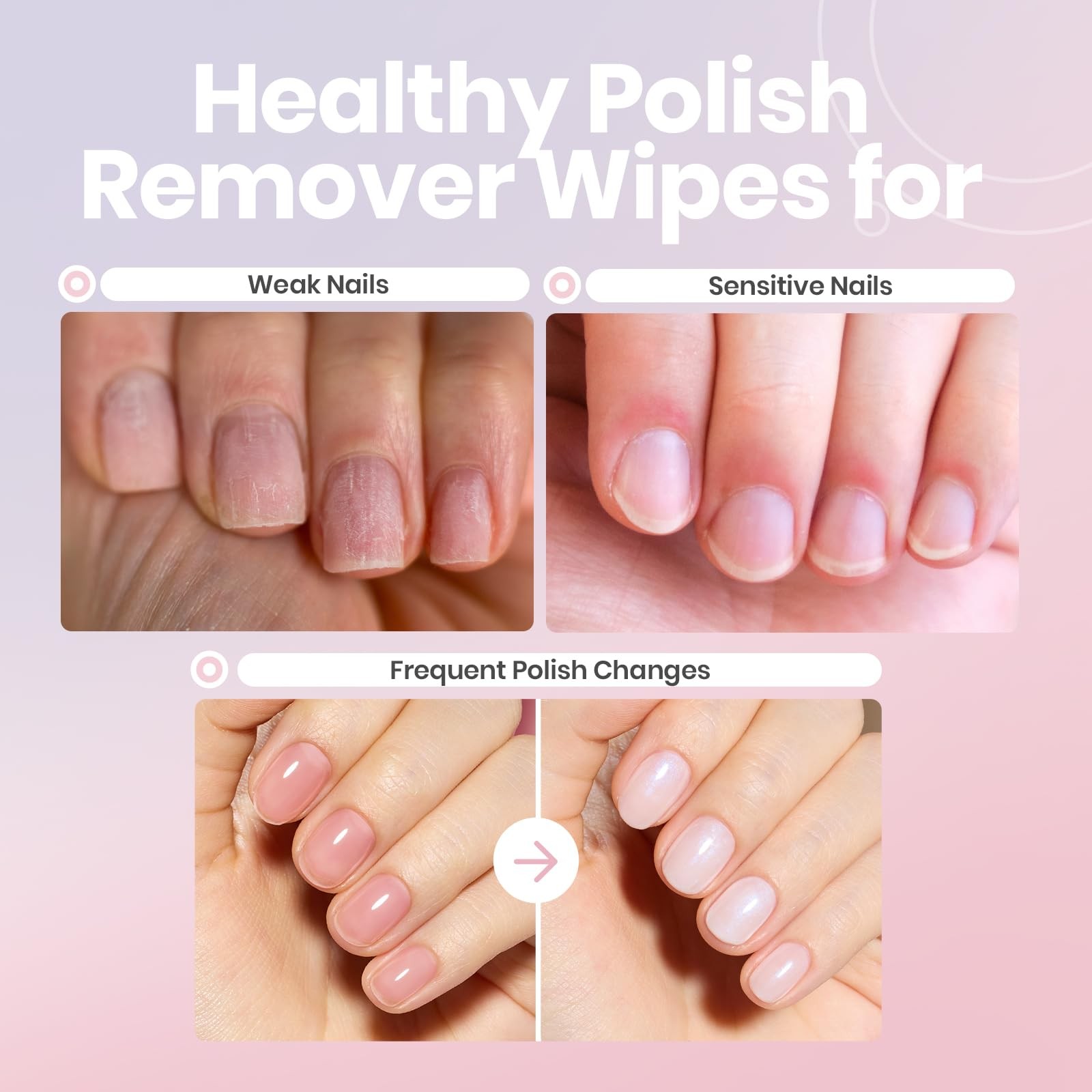 Beetles Nail Polish Remover Wipes – 0.01 Fl Oz (Pack of 100), 59.14ML