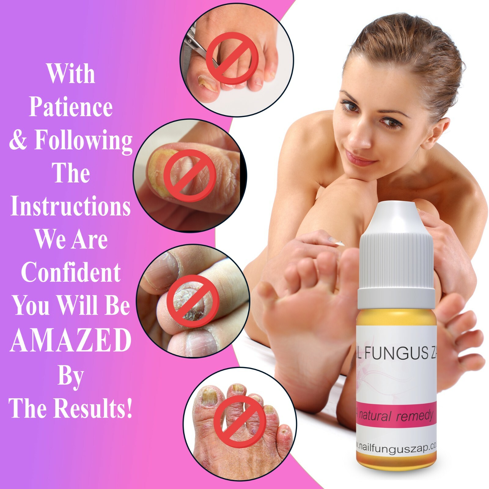 Anti Fungal Treatment NAIL FUNGUS ZAP Natural Toe Nail Fungus Infection UK 20ML
